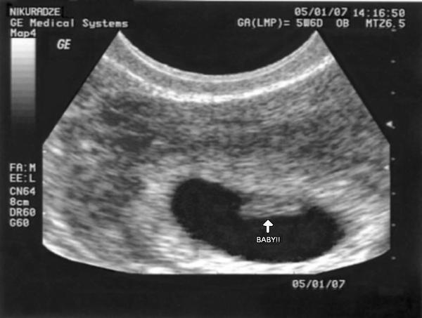 ultrasound3.jpg
